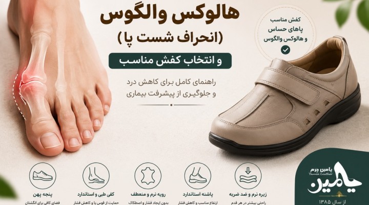 هالگوس والگوس چیست و چه کفشی  برای آن مناسب است